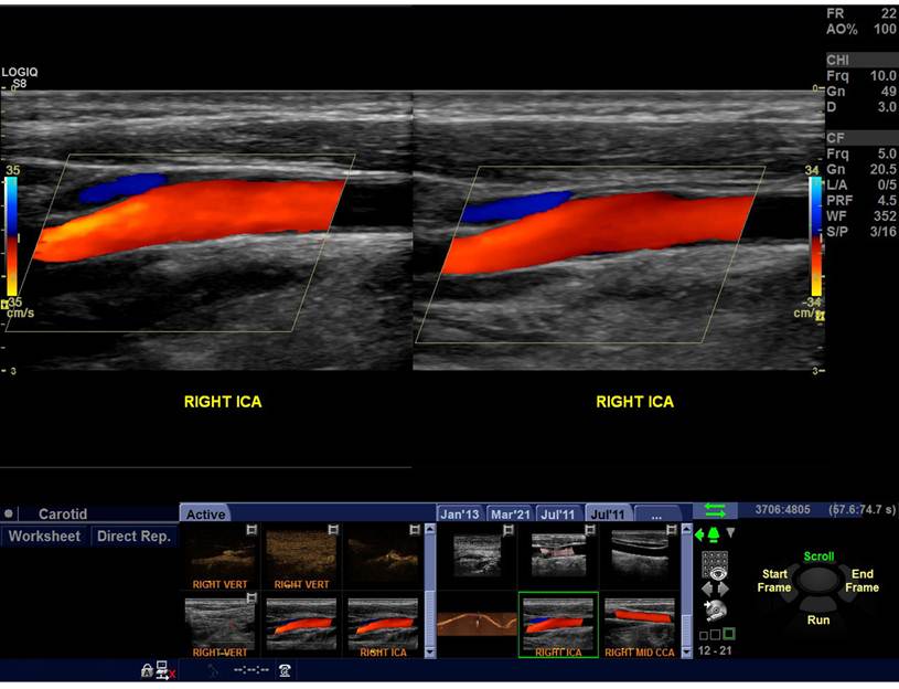 GE Advances LOGIQ S8 Ultrasound System | Imaging Technology News